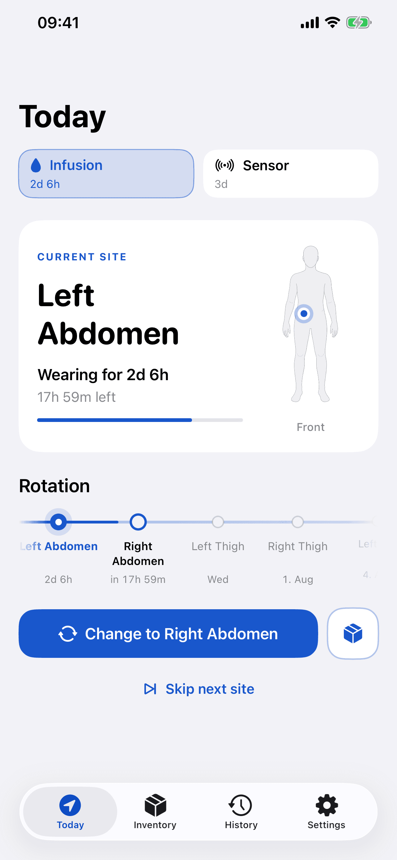 Current infusion site and wear time on the Today screen